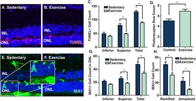 Voluntary exercise modulates pathways associated with amelioration of retinal degenerative diseases